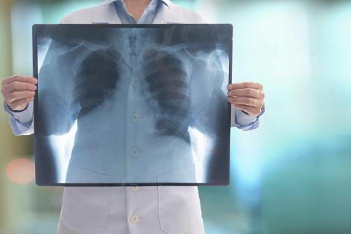 TÉCNICO SUPERIOR EN IMAGEN PARA EL DIAGNÓSTICO Y MEDICINA NUCLEAR Imagen