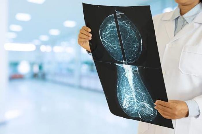 Técnico superior en imagen para el diagnóstico y medicina nuclear Imagen