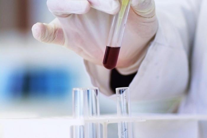 TÉCNICO SUPERIOR EN LABORATORIO CLÍNICO Y BIOMÉDICO ONLINE Imagen