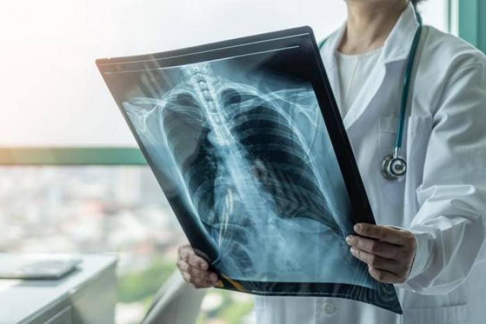 Técnico Superior en Radioterapia Dosimetría Imagen